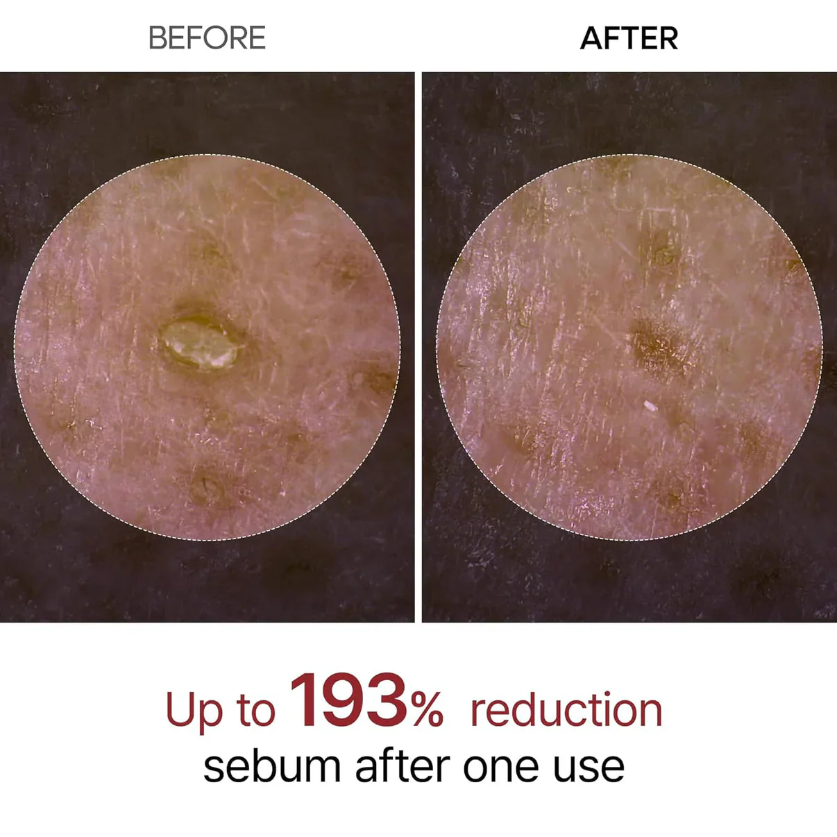 Eloria Rice Peel Serum Ampoule™ - Image 5