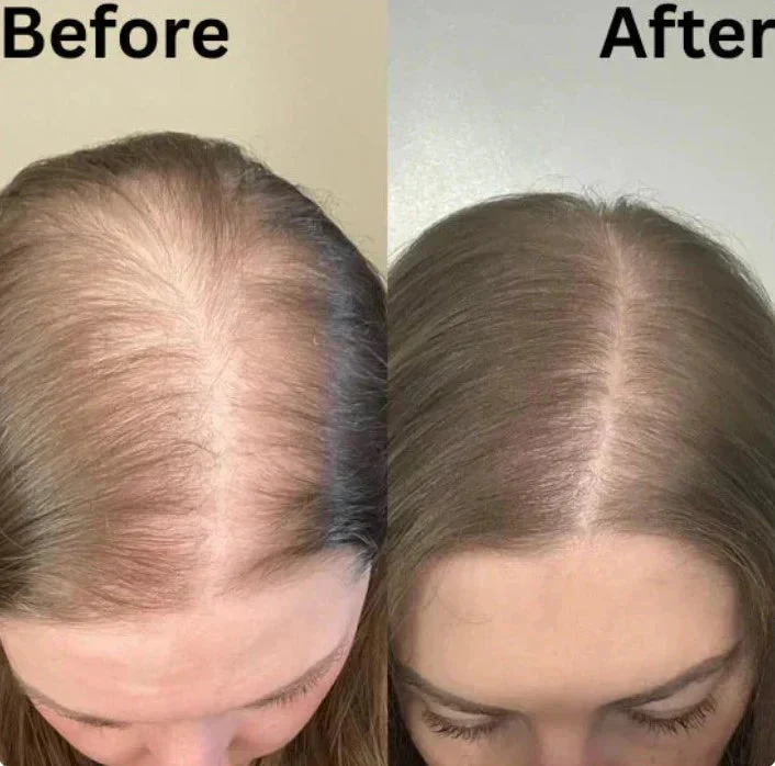 Organic Rosemary Hair Growth Shampoo - Image 10