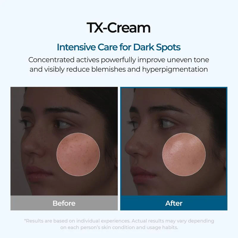 TX - Cream - Image 2